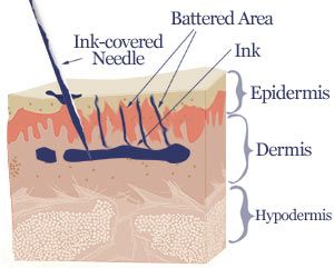 cross section diagram of a tattoo gun delivering ink into the dermis layer of skin